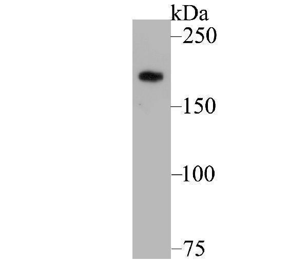 a01171 1 gli3 primary antiboties wb testing 1