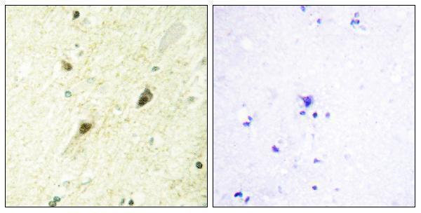 a01171 2 gli3 primary antibodies ihc testing 2