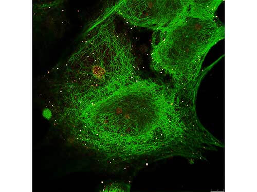 a01171 gli3 primary antibodies if testing 4_1