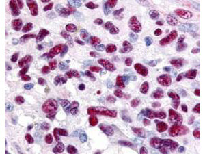a01171 gli3 primary antibodies ihc testing 1_1