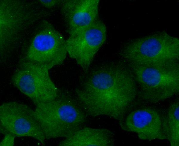 ICC staining GCN2 in A549 cells (green)