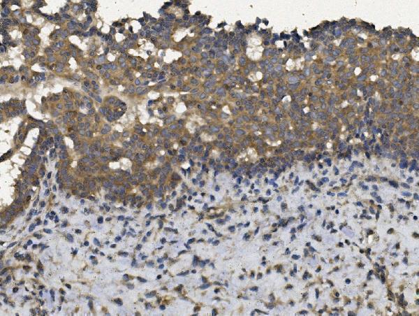  IHC analysis of EIF2AK4 using anti-EIF2AK4 antibody (A01172-2)