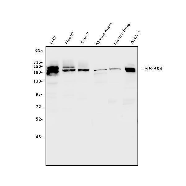  Western blot analysis of EIF2AK4 using anti-EIF2AK4 antibody (A01172-2)