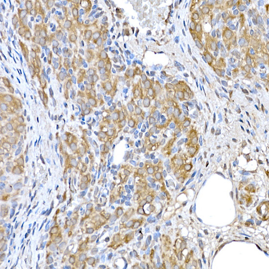 Immunohistochemistry of paraffin-embedded rat ovary using GCN2 Rabbit pAb  at dilution of 1:250 
