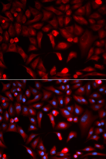 Immunofluorescence analysis of Hela cells, using PKM2 polyclonal antibody