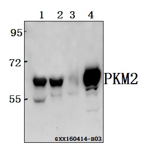 Western blot (WB) analysis of PKM2 polyclonal antibody at 1:500 dilution
Lane1:C6 whole cell lysate(40ug)
Lane2:HEK293T whole cell lysate(40ug)
Lane3:The stomach tissue lysate of Mouse(40ug)
Lane4:MCF-7 whole cell lysate(20ug)