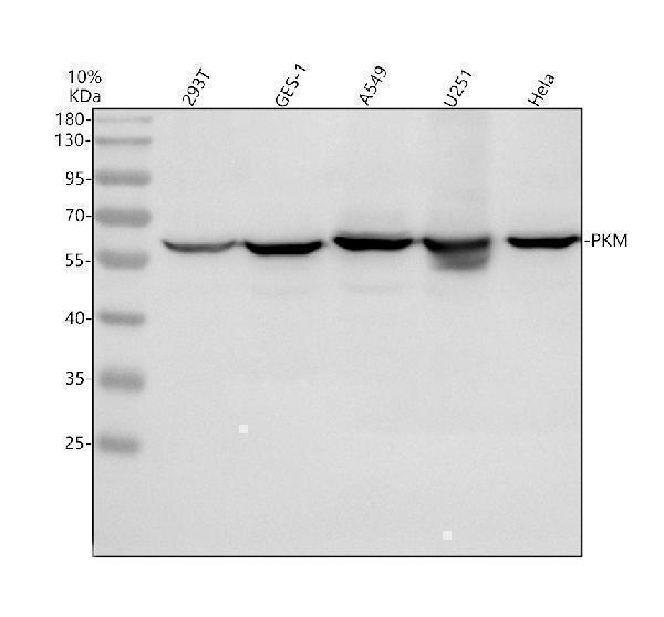 Western blot analysis of PKM2 using anti-PKM2 antibody (A01173-2)