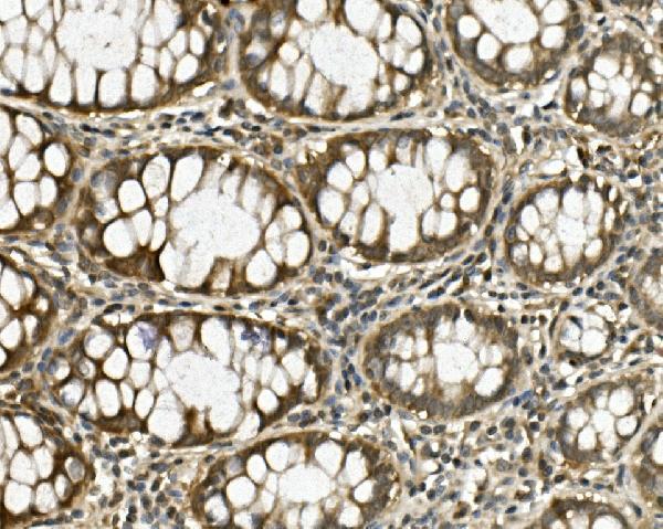 a01174 1 hgs primary antibodies ihc testing 4