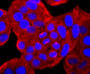 ICC staining SERCA2 in Hela cells (red)