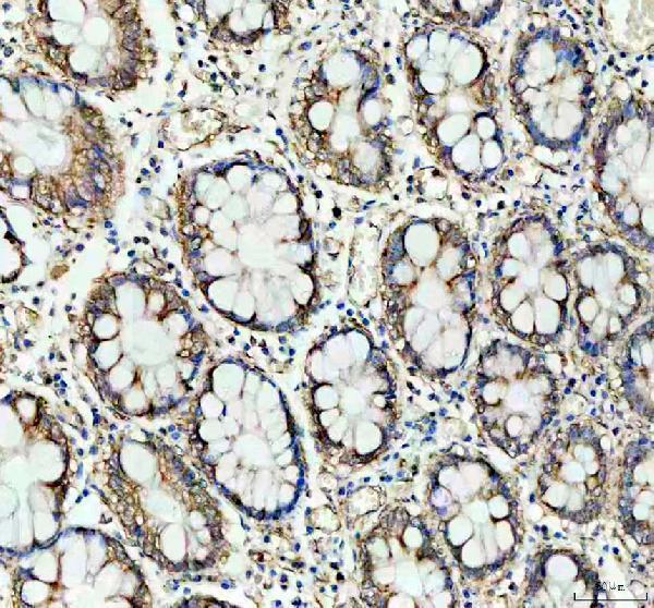 a01178 1 phb primary antibodies ihc testing 1