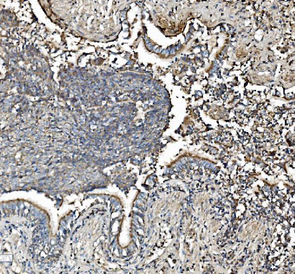 a01178 1 phb primary antibodies ihc testing 2_1