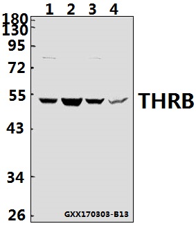 Western blot (WB) analysis of THRB (L37) polyclonal antibody at 1:500 dilution
Lane1:A549 whole cell lysate(40ug)
Lane2:HCT116 whole cell lysate(40ug)
Lane3:BV2 whole cell lysate(40ug)
Lane4:PC12 whole cell lysate(40ug)