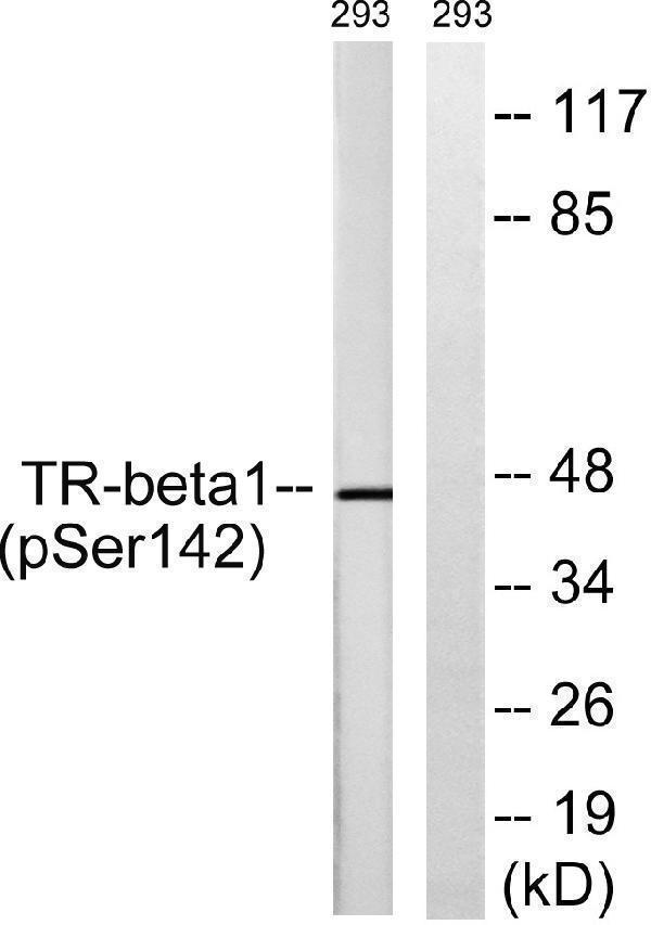 Western blot analysis of lysates from 293 cells treated with PMA 125ng/ml 30', using TR-beta1 (Phospho-Ser142) Antibody