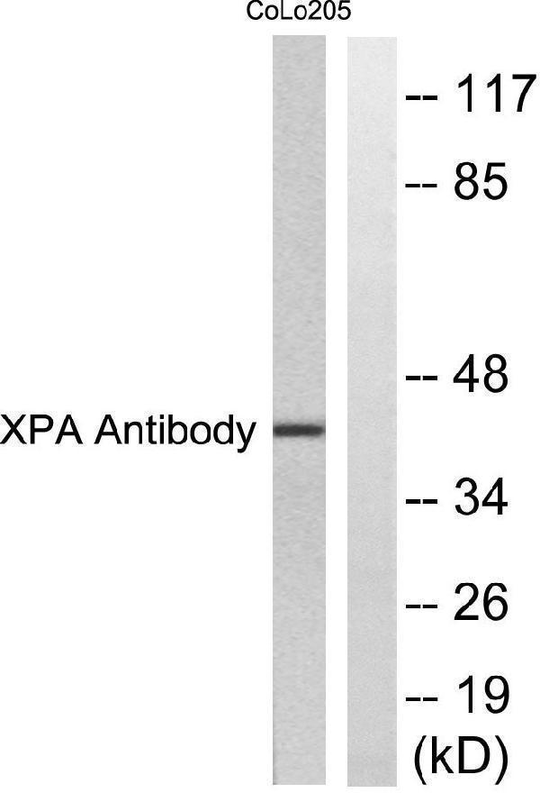 Western blot analysis of lysates from COLO205 cells, using XPA Antibody