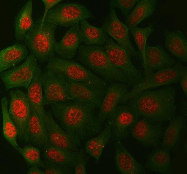  IF analysis of XPA using anti-XPA antibody (A01182-4) and anti-Beta Tubulin antibody (M01857-3)