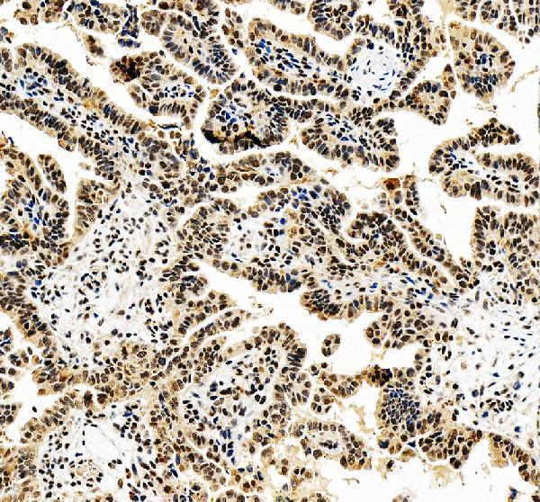 IHC analysis of FOXL2 using anti-FOXL2 antibody (A01185-1)