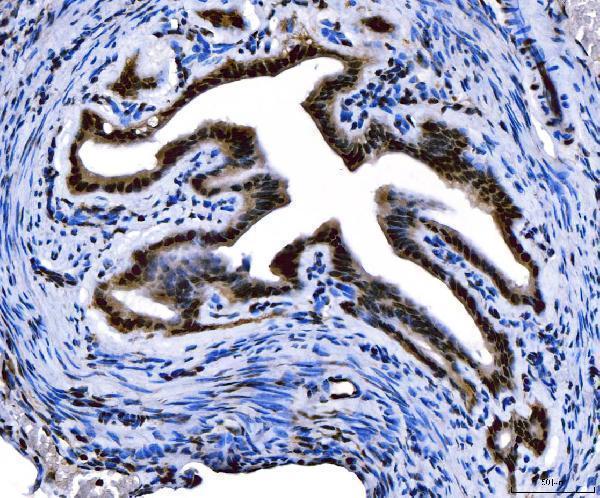 a01185 1 foxl2 primary antibodies ihc testing 2