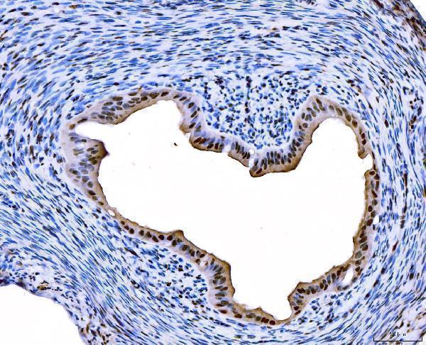 a01185 1 foxl2 primary antibodies ihc testing 3