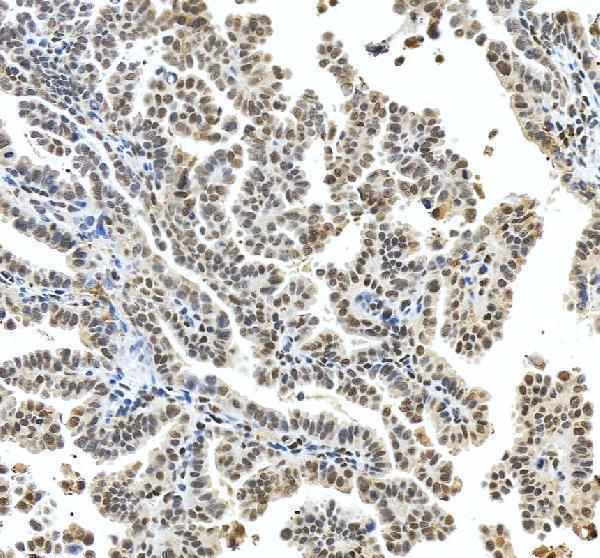 IHC analysis of FOXL2 using anti-FOXL2 antibody (A01185-1)