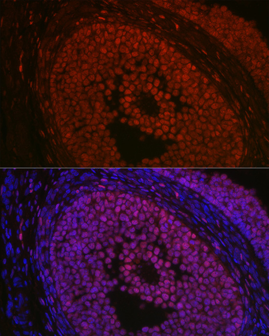 Immunofluorescence analysis of rat ovary using FOXL2 Rabbit pAb  at dilution of 1:100 