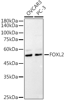 Western blot analysis of extracts of various cell lines, using   at 1:1000 dilution