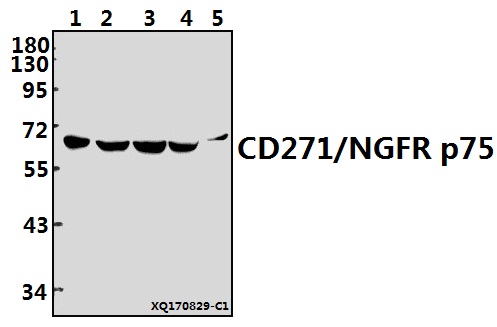 a01187 3 ngfr primary antiboties wb testing 1