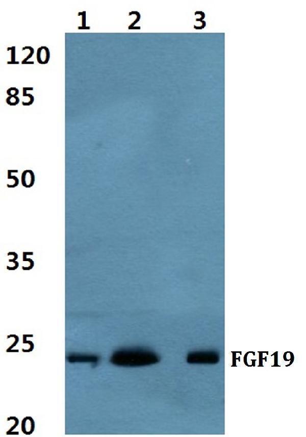 Western blot (WB) analysis of FGF19 polyclonal antibody at 1:500 dilution
Lane1:Hela cell lysate
Lane2:Mouse liver tissue lysate
Lane3:Rat liver tissue lysate