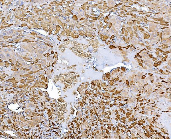 a01192 4 chat primary antibodies ihc testing 2