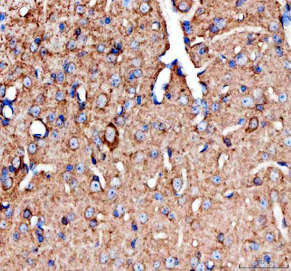 a01192 5 chat primary antibodies ihc testing 1