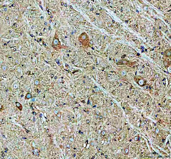 a01192 5 chat primary antibodies ihc testing 2_1