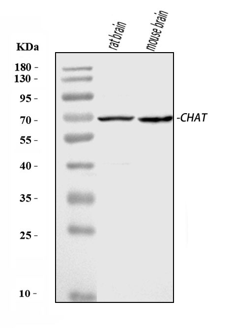  Western blot analysis of Choline Acetyltransferase/CHAT using anti-Choline Acetyltransferase/CHAT antibody (A01192-6)