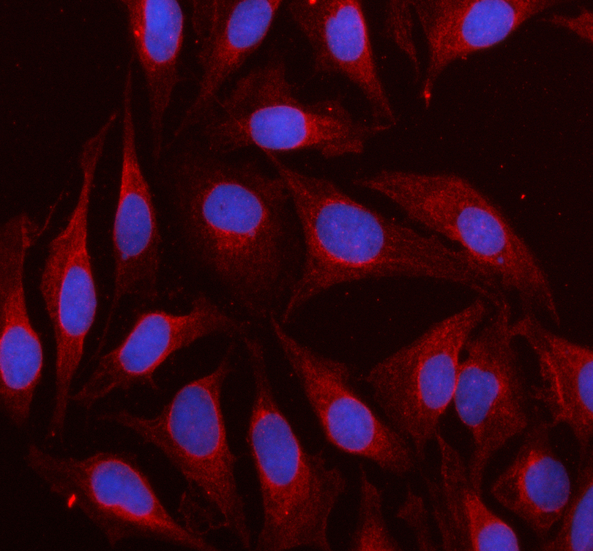 a01193 2 mapkapk2 primary antibodies if testing 1
