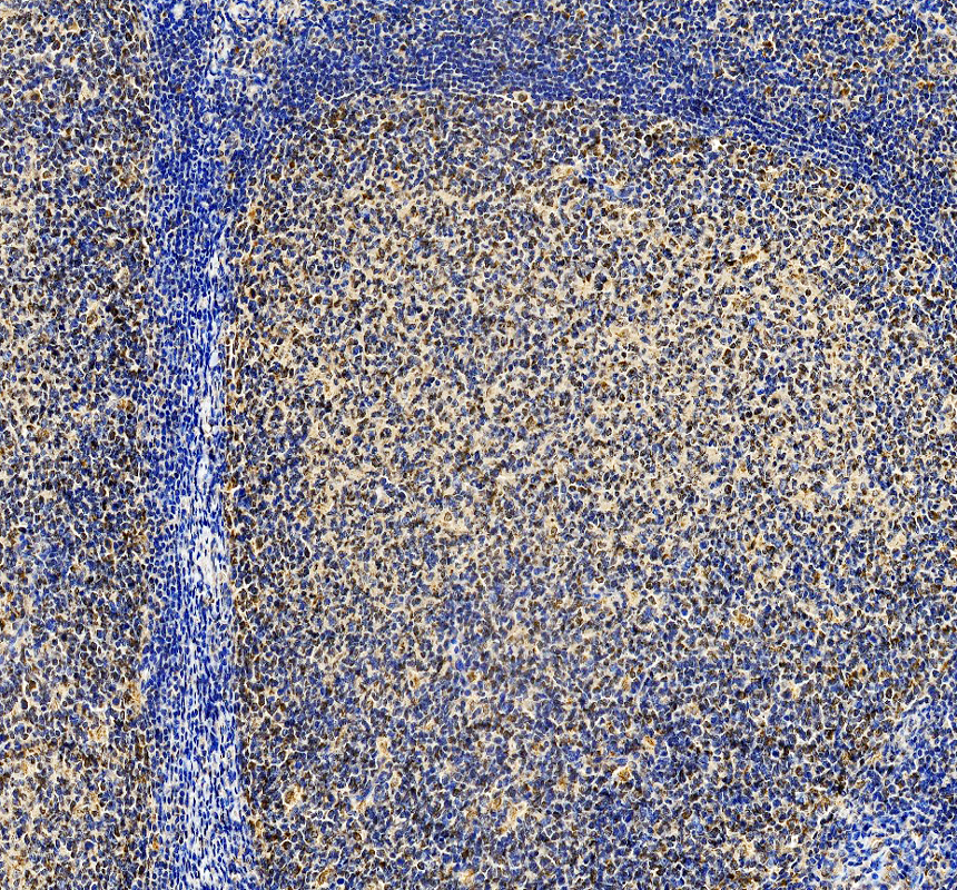 a01193 2 mapkapk2 primary antibodies ihc testing 1