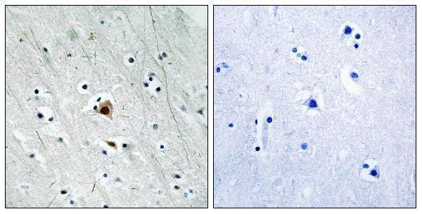 Immunohistochemistry analysis of paraffin-embedded human brain, using MAPKAPK2 (Phospho-Ser272) Antibody