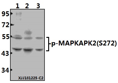 Western blot (WB) analysis of MAPKAPK-2 (phospho-S272) polyclonal antibody at 1:500 dilution
Lane1:Hela whole cell lysate(40ug)
Lane2:The Spleen tissue lysate of Mouse(40ug)
Lane3:The Spleen tissue lysate of Rat(40ug)
