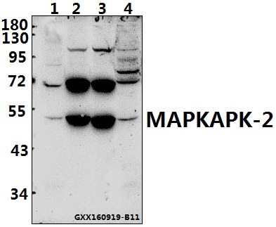 Western blot (WB) analysis of MAPKAPK-2 (S328) polyclonal antibody at 1:500 dilution
Lane1:C6 whole cell lysate(40ug)
Lane2:The Brain tissue lysate of Rat(40ug)
Lane3:The Brain tissue lysate of Mouse(40ug)
Lane4:HEK293T whole cell lysate(40ug)