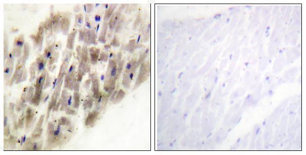 Immunohistochemistry analysis of paraffin-embedded human heart, using MAPKAPK-2 (Phospho-Thr222) Antibody