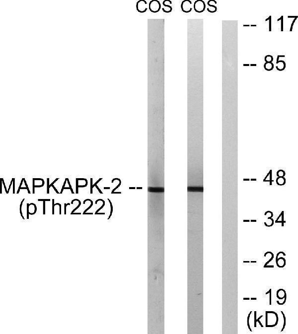 Western blot analysis of lysates from COS7 cells treated with UV 15', using MAPKAPK-2 (Phospho-Thr222) Antibody