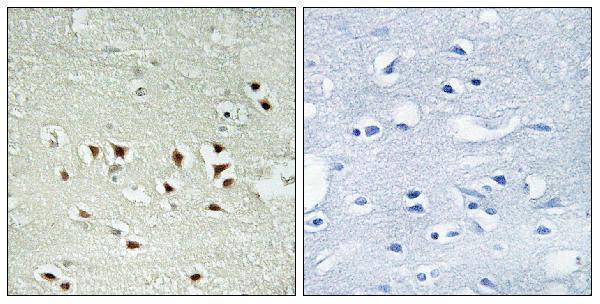 Immunohistochemistry analysis of paraffin-embedded human brain, using MAPKAPK2 (Phospho-Thr334) Antibody