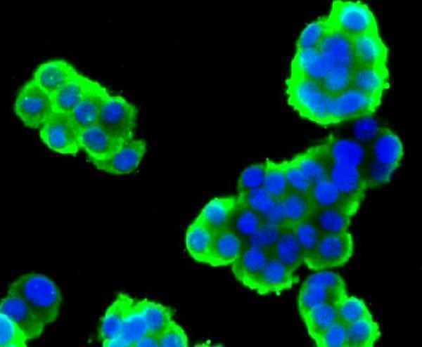 ICC staining Stathmin 1 in PC-12 cells (green)