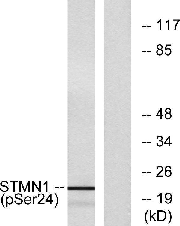 Western blot analysis of lysates from Jurkat cells treated with PMA 1ng/ml 15