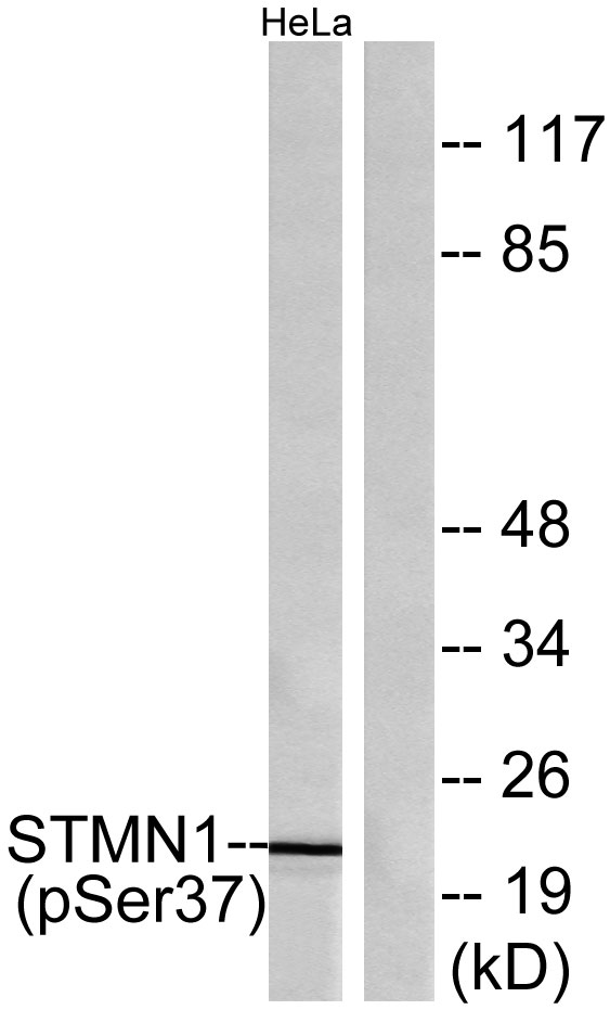 Western blot analysis of lysates from HeLa cells treated with nocodazole, using Stathmin 1 (Phospho-Ser37) Antibody