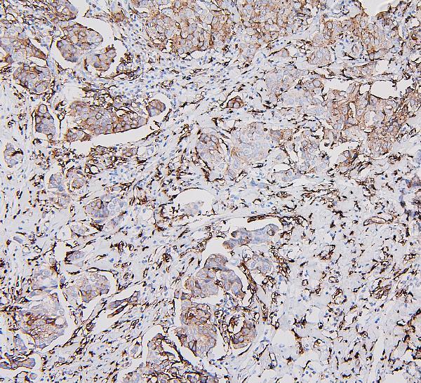  IHC analysis of HLA-DRA using anti-HLA-DRA antibody (A01195)