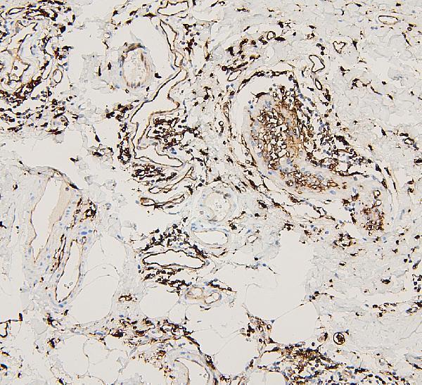  IHC analysis of HLA-DRA using anti-HLA-DRA antibody (A01195)