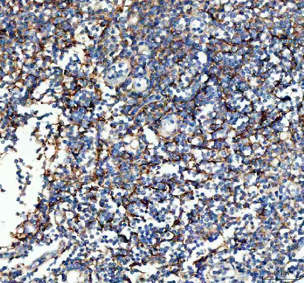 a01199 1 vcam1 primary antibodies ihc testing 3