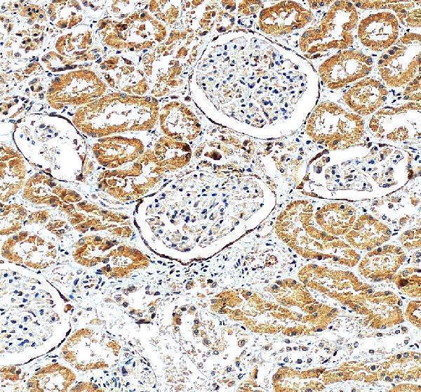 a01199 1 vcam1 primary antibodies ihc testing 4