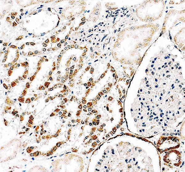 IHC analysis of VCAM1 using anti-VCAM1 antibody (A01199-4)