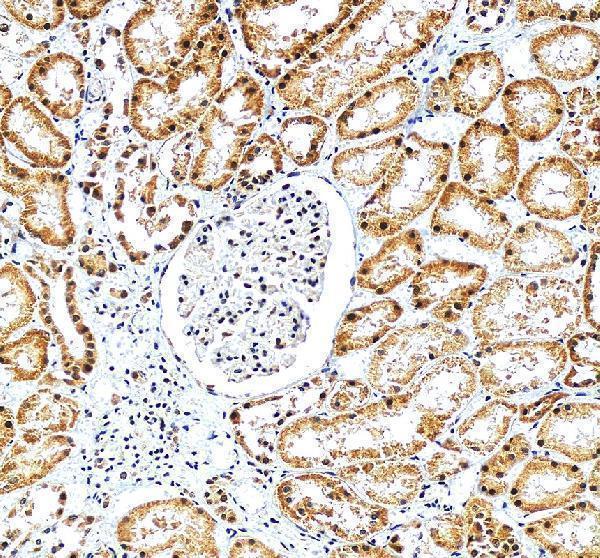 a01199 vcam1 primary antibodies ihc testing 3