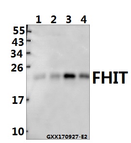 Western blot (WB) analysis of FHIT (E116) pAb at 1:500 dilution
Lane1:SK-OVCAR3 whole cell lysate(40ug)
Lane2:The Kidney tissue lysate of Mouse(40ug)
Lane3:MCF-7 whole cell lysate(40ug)
Lane4:SGC7901 whole cell lysate(40ug)