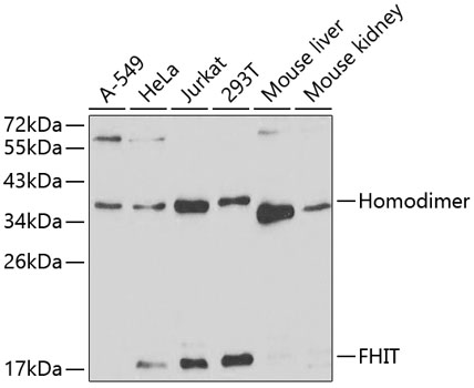 Western blot analysis of extracts of various cell lines, using FHIT antibody  at 1:1000 dilution